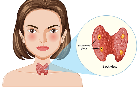 Gynecological Cancer
