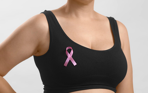 Breast Cancer